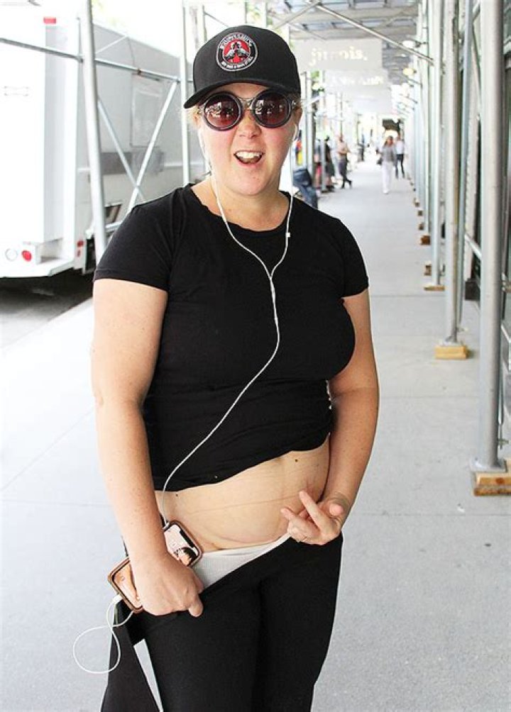 Amy Schumer Shows Off Her C-Section Scar While Out Jogging In NYC