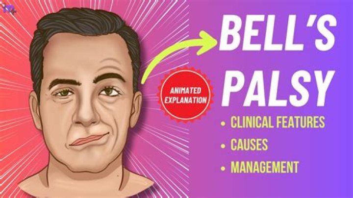 Andrew Dice Clay Shares Selfie Photo After Developing Bell’s Palsy – Hollywood Life