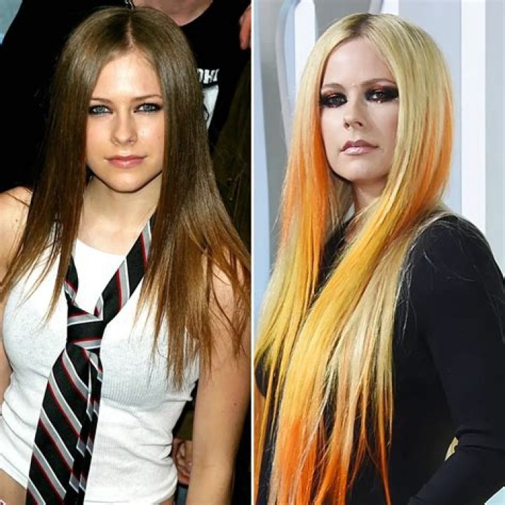Avril Lavigne Nose Job Plastic Surgery Before and After