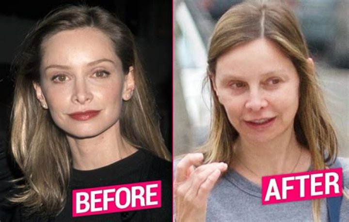 Calista Flockhart Plastic Surgery: Secrets Behind 59-Year-Old Calista's Seemless Beauty!