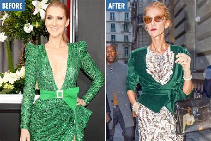 Celine Dion Weight Loss: Celine Dion's Eating Disorder, Unhealthy Lifestyle or Severe Syndrome?