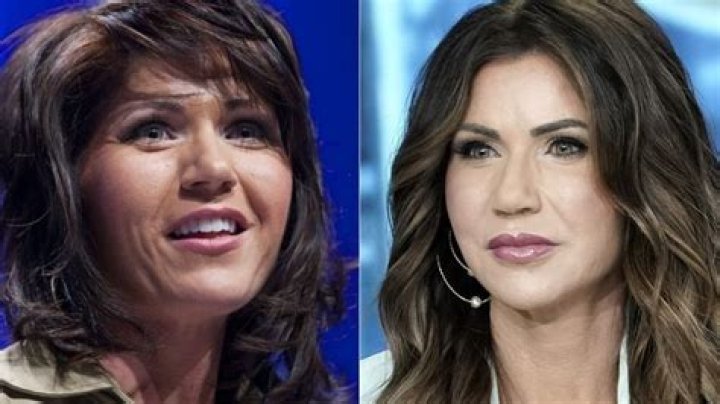 Chaney Jones Admits To Having A BBL But Denies Plastic Surgery On Face – Hollywood Life