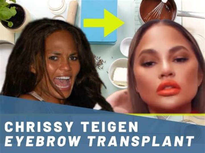 Chrissy Teigen Gets Eyebrow Transplants: Photos – Hollywood Life