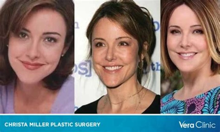 Christa Miller Plastic Surgery: Christa's Surgery or Skincare Should Be Credited?