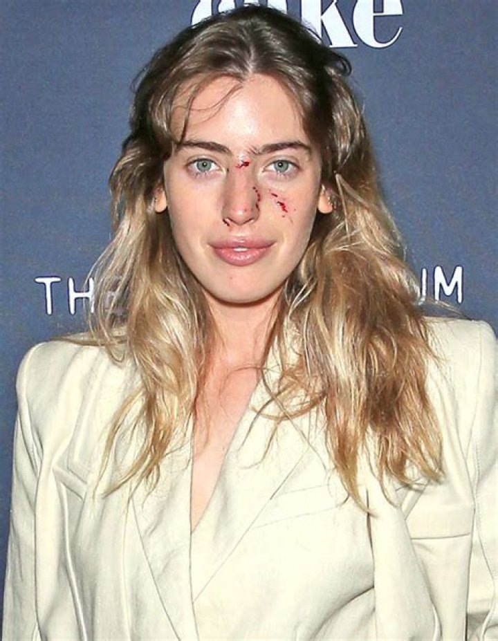 Ewan McGregor’s Daughter Clara Gets Bit In The Face By A Dog & Walks Red Carpet With Painful Scratches