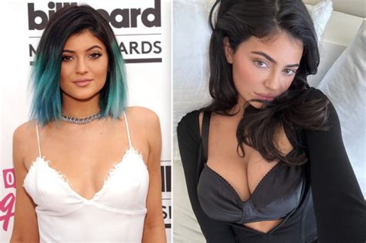Did Kylie Jenner Get Breast Implants? See Before & After Photos – Hollywood Life
