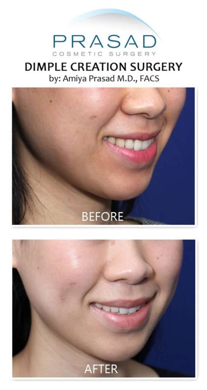 What Is The Millennial Beauty Trend — Doctor Tips – Hollywood Life