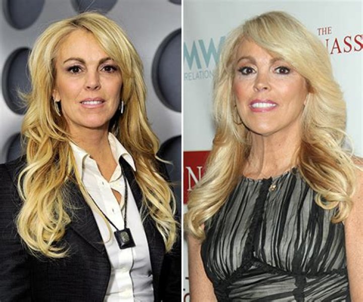 Dina Lohan On ‘Millionaire Matchmaker’ — Gets Free Face Lift, Says Report – Hollywood Life