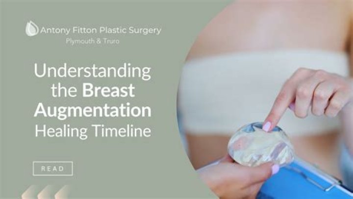 She’s Getting Breast Implants – Hollywood Life