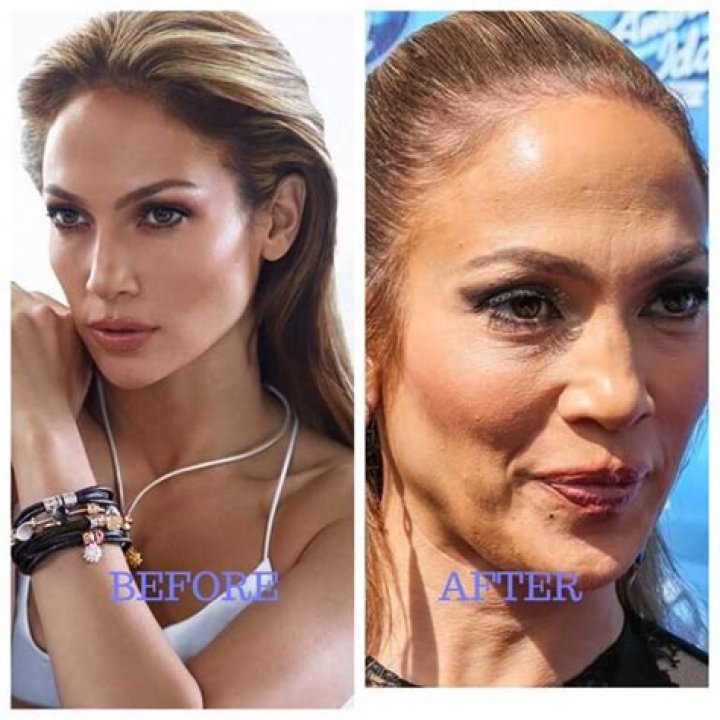 Has Jennifer Lopez had Plastic Surgery: From Rumors to Reality