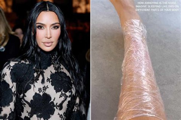 How To Treat Psoriasis — Methods To Deal With Kim Kardashian’s Skin Condition – Hollywood Life