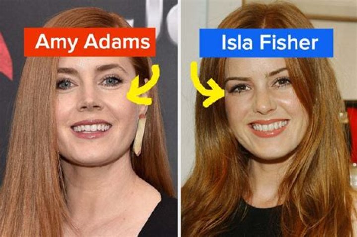 Isla Fisher Plastic Surgery Before and After
