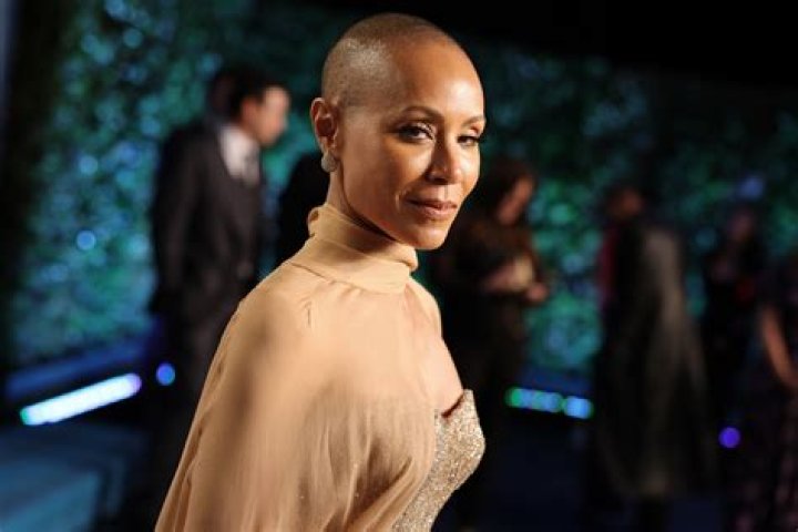 Jada Pinkett-Smith Shows Off Hair Loss Line Due To Alopecia: ‘I Can Only Laugh’ — Watch