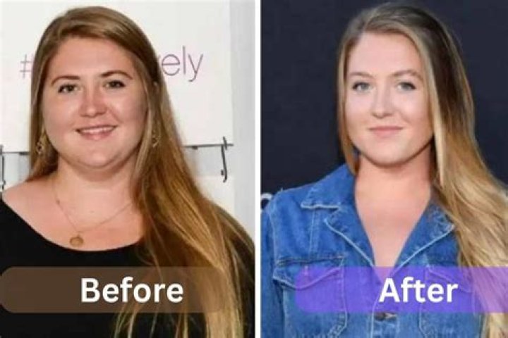 Jaicy Elliot Weight Loss: A Journey to Health and Self-Acceptance