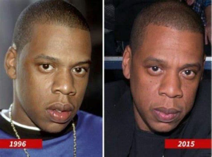 Jay-Z Nose Job Plastic Surgery Before and After