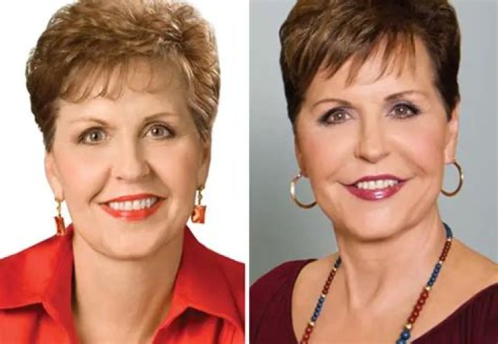Joyce Meyer Lip Augmentation Plastic Surgery Before and After