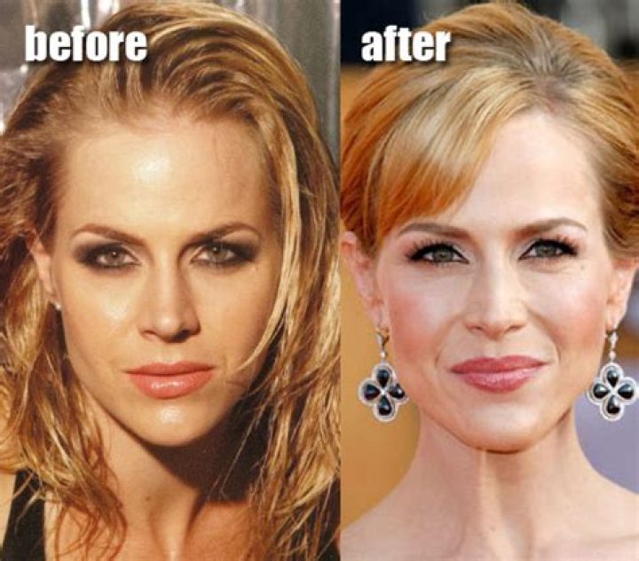 Julie Benz Plastic Surgery Before and After