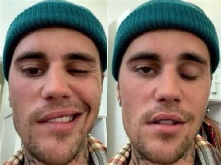 Justin Bieber’s Face & Smile Revealed After Ramsay Hunt Syndrome – Hollywood Life