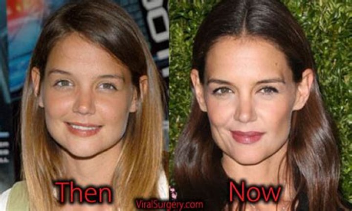 Katie Holmes Plastic Surgery Before and After