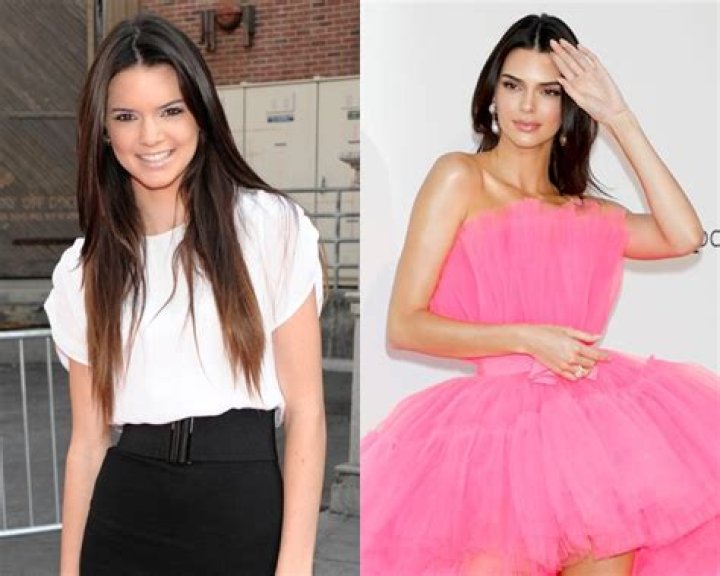 Kendall Jenner Then & Now: Photos – Hollywood Life