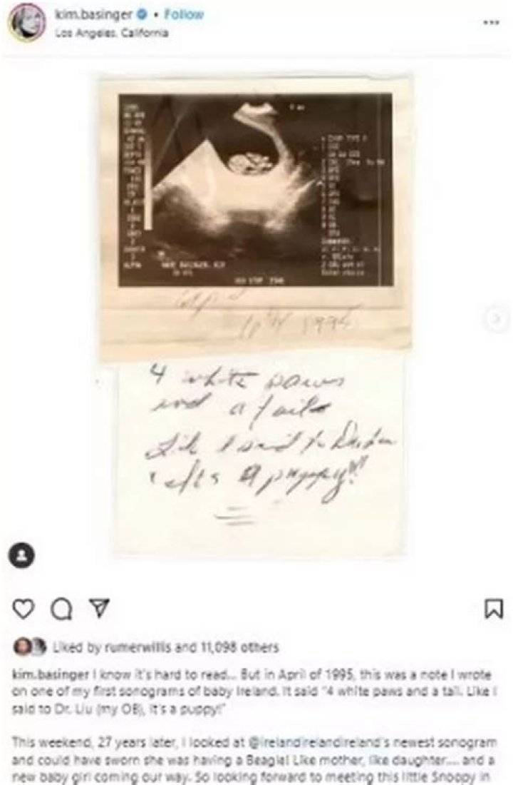 Kim Basinger Gushes Over Daughter Ireland’s Pregnancy As She Compares Their Sonograms