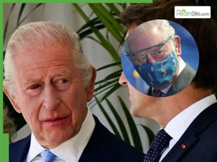 King Charles’ Health: Buckingham Palace Denies False Death Report