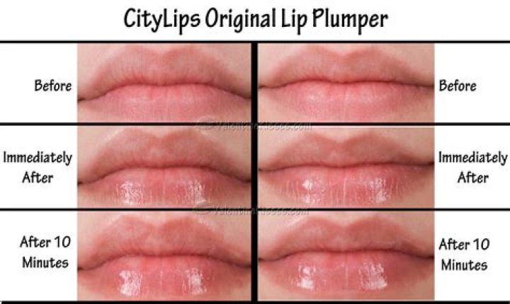 Premium Lip Plumpers (Review) of 2023
