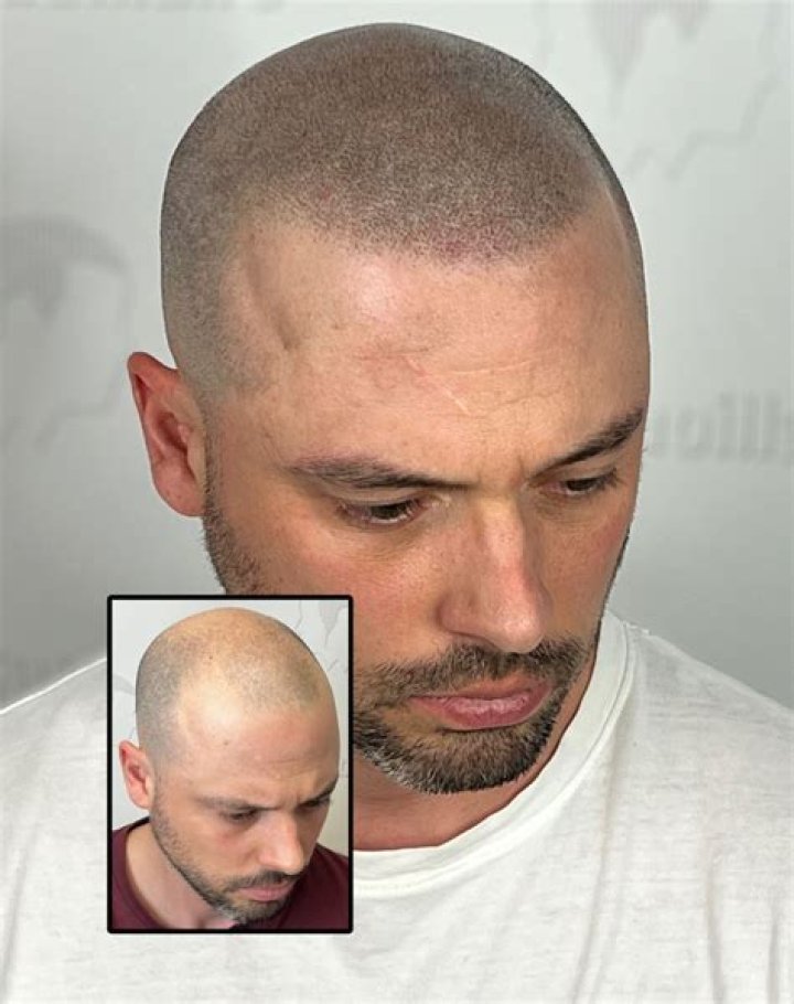 Machine Gun Kelly Reveals Head Tattoo After Shaving Hair – Hollywood Life