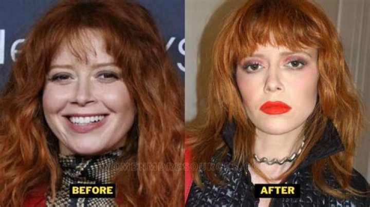 Natasha Lyonne Plastic Surgery: Natasha Lyonne's Empowering Message on Aging Naturally!
