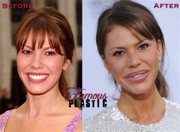 Nikki Cox Plastic Surgery Before and After