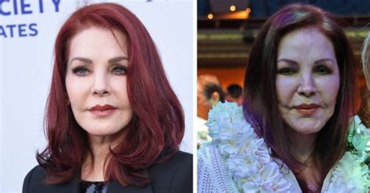 THE NEWEST BOTCHED FACE! Top Plastic Surgeons Say Daryl Hannah Has Had Fillers In Her Lips, Checks, AND A Possible Nose Job! – Hollywood Life