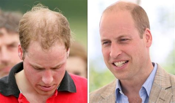 Duke Of Cambridge Shows Off Much Shorter ‘Do – Hollywood Life