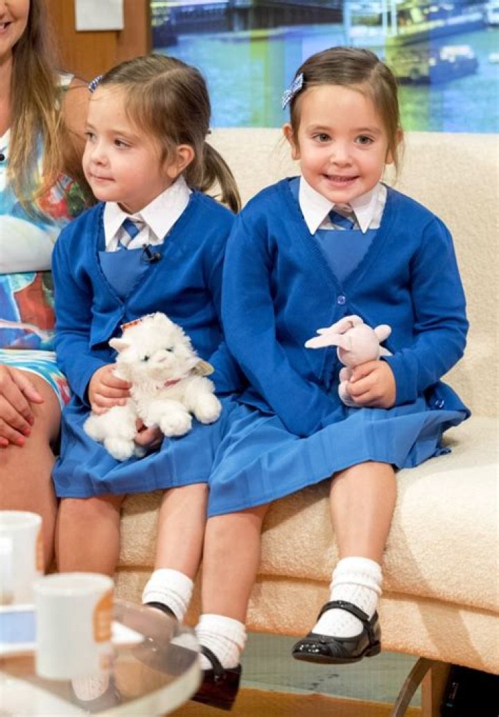 [PICS] Rosie & Ruby Formosa Pictures — See The Formerly Conjoined Twins – Hollywood Life