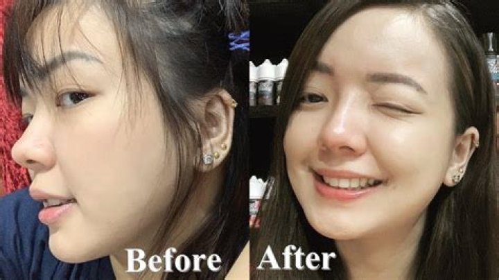 Rosmar Tan Plastic Surgery: Her Changing Looks Attributed to Her Special Skincare?