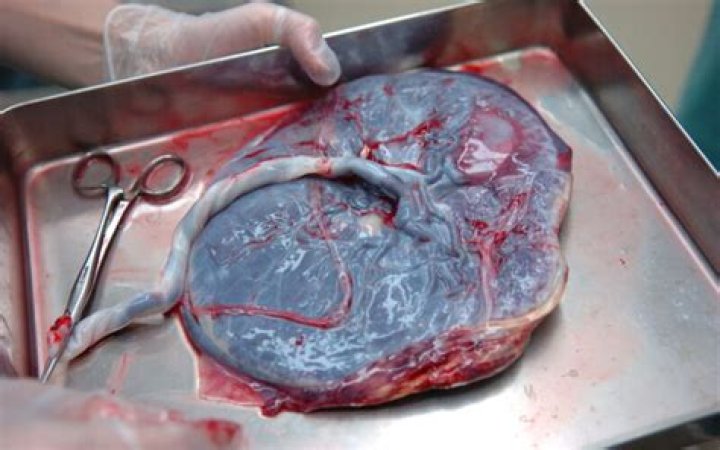 Sharna Burgess Explains Why She’s Eating Her Own Placenta After Birth Of Her Son