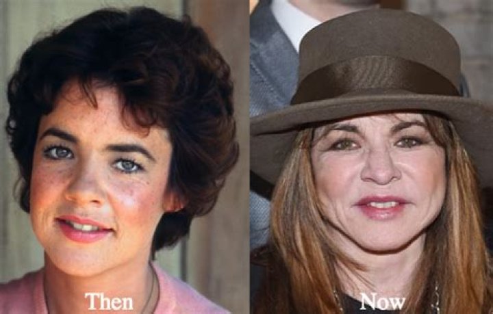 Stockard Channing Got Plastic Surgery On Her Face? — Doctor Speaks – Hollywood Life