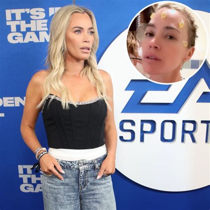 About Her Melanoma Diagnosis – Hollywood Life