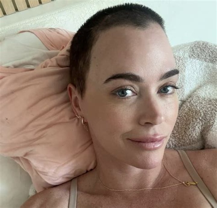 Teddi Mellencamp Bravely Shares Melanoma Cancer Update: Photos – Hollywood Life