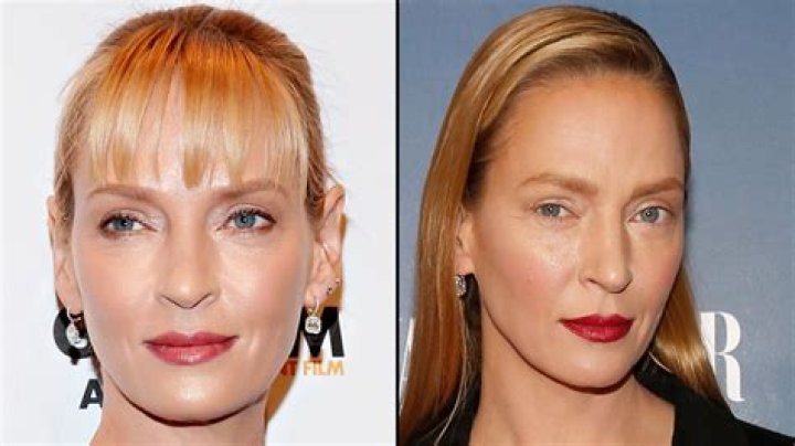 Before & After — Did She Get Plastic Surgery On Her Face? – Hollywood Life
