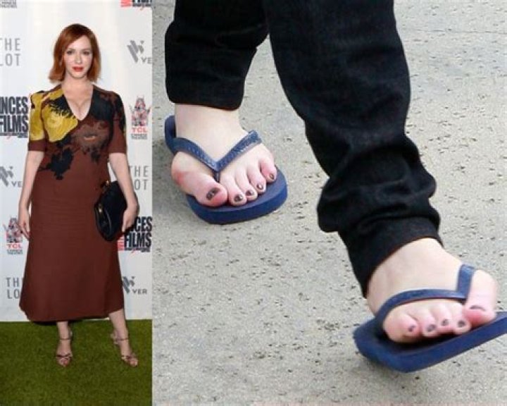 Stars With Freaky Feet & Toes — PICS