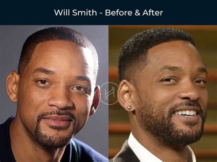 Actor Goes Grey – Before & After Photos – Hollywood Life